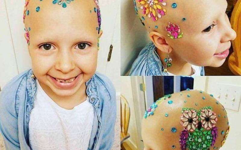 image for Girl with alopecia wins competition with gorgeous jeweled head