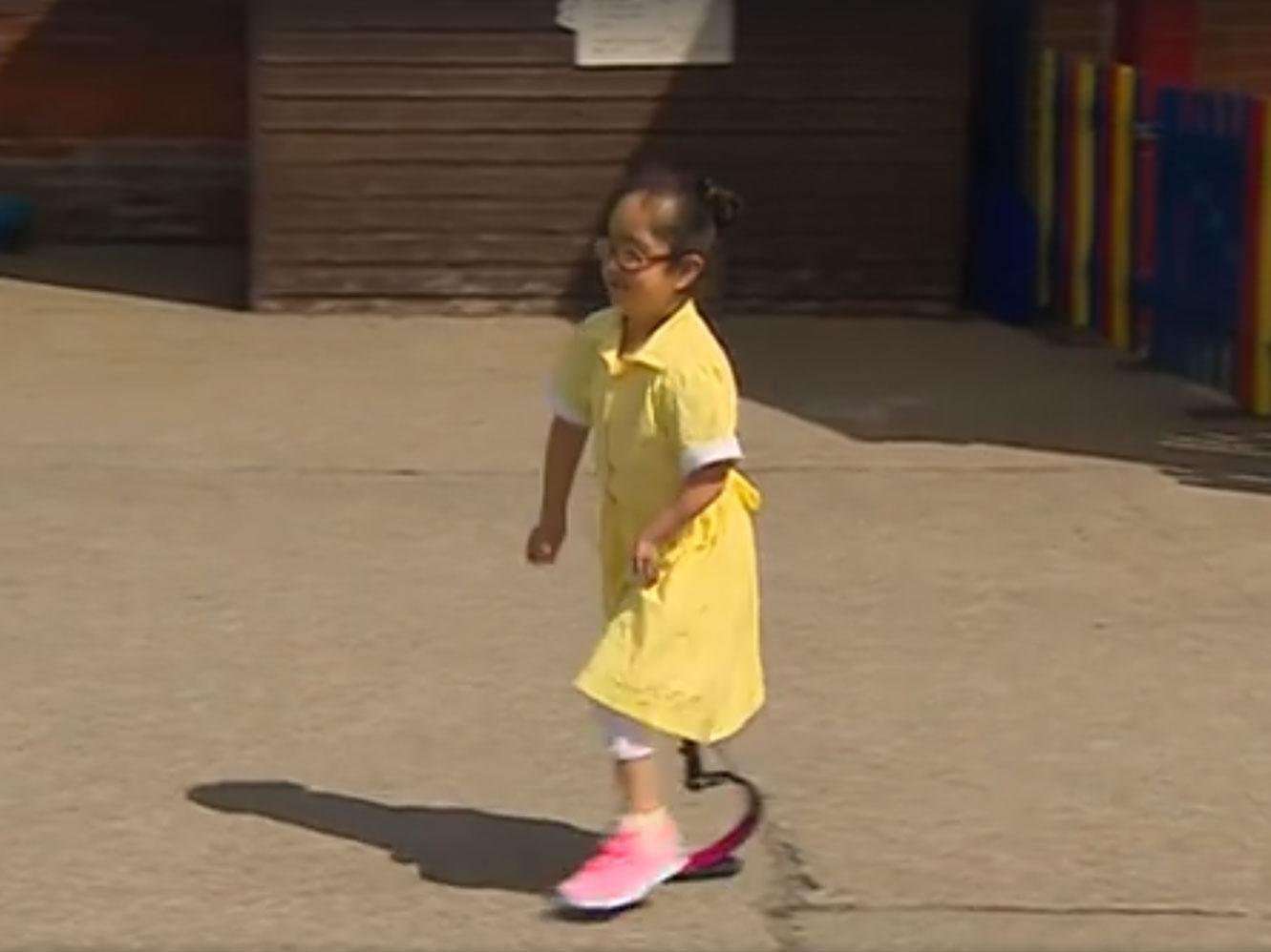 image for Seven-year-old girl shows friends her new prosthetic leg for first time and their reaction is beautiful