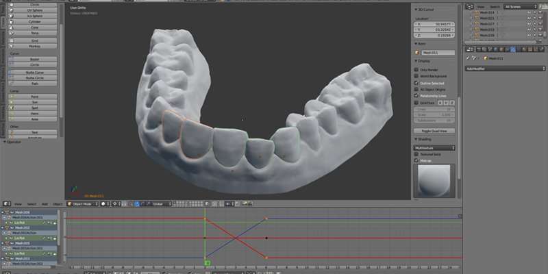 image for This guy fixed his teeth by 3D printing his own plastic braces for $60