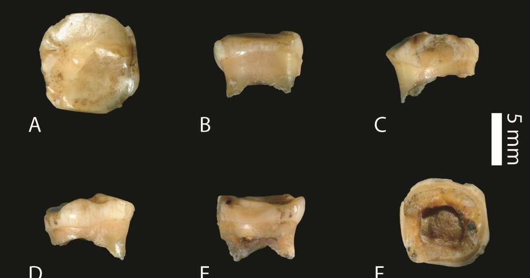 image for In a Lost Baby Tooth, Scientists Find Ancient Denisovan DNA