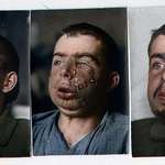 image for Before and after the facial reconstruction of a wounded soldier during World War 1.