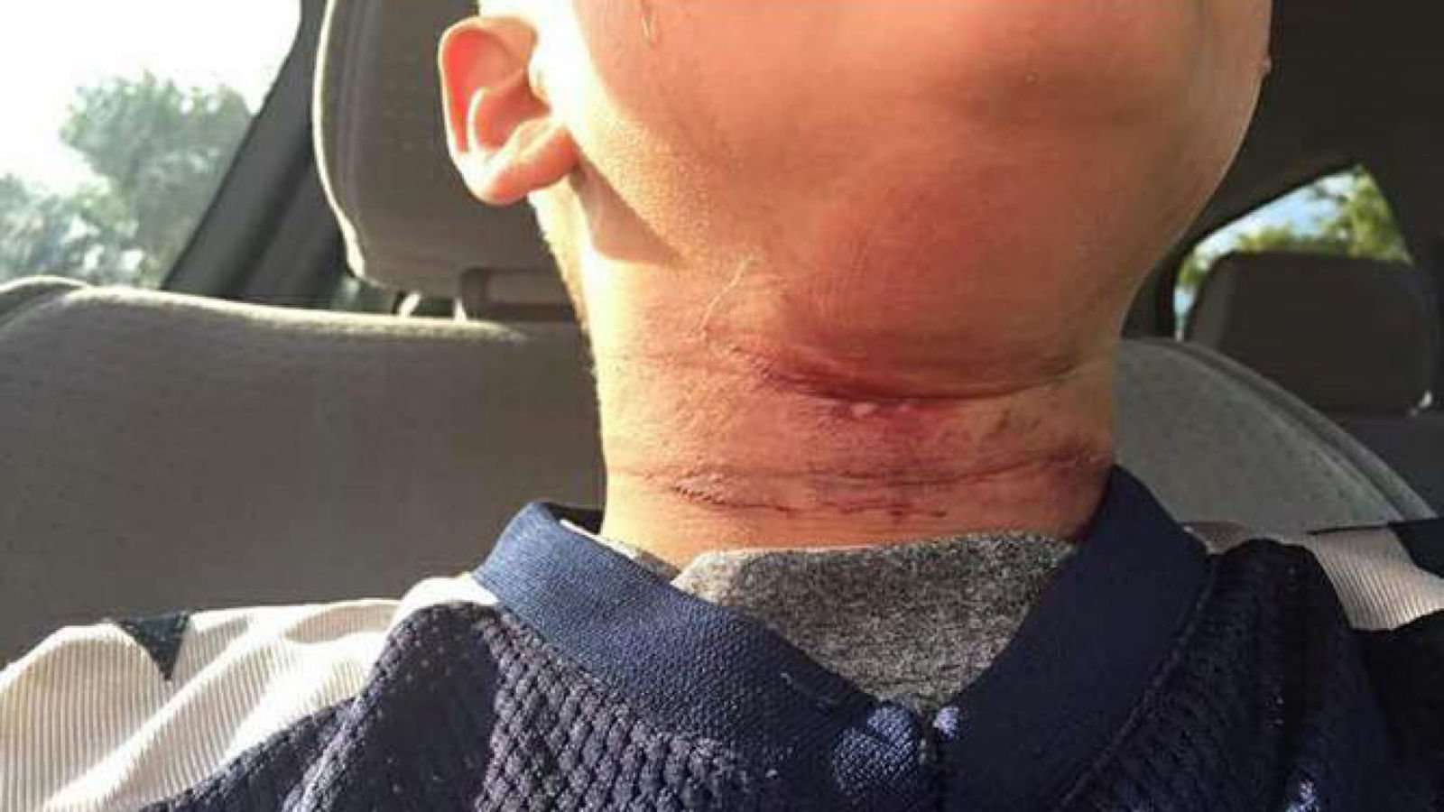 image for Protest after biracial boy, eight, nearly hanged by teenagers