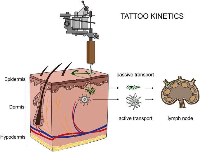 image for Synchrotron-based ν-XRF mapping and μ-FTIR microscopy enable to look into the fate and effects of tattoo pigments in human skin
