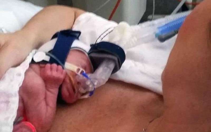 image for Premature babies: Simple procedure by Australian doctors could save thousands of lives each year
