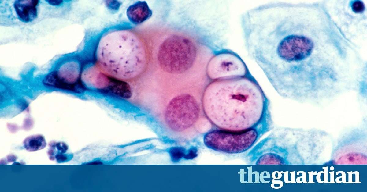 image for Online STI kits double testing uptake in young people, study suggests