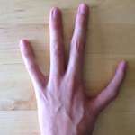 image for I have only four fingers on my left hand, and have and index finger instead of my thumb
