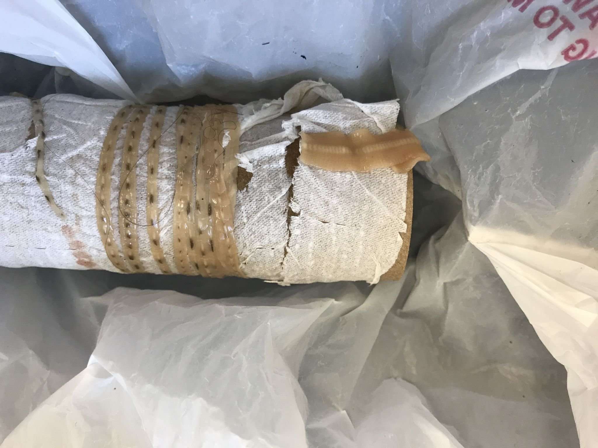 image for Sushi lover pulled a 5-foot tapeworm from intestine, Fresno doc says