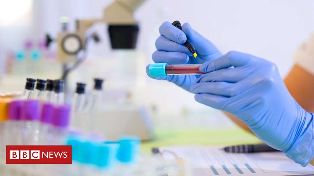 image for Cancer blood test ‘enormously exciting’