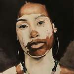 image for "Vitiligo", watercolour, 25x50 cm