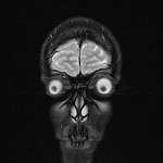 image for MRI of my face