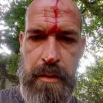 image for Got hit by a failing branch on the way home from work. Turns out that I'm actually Kratos..