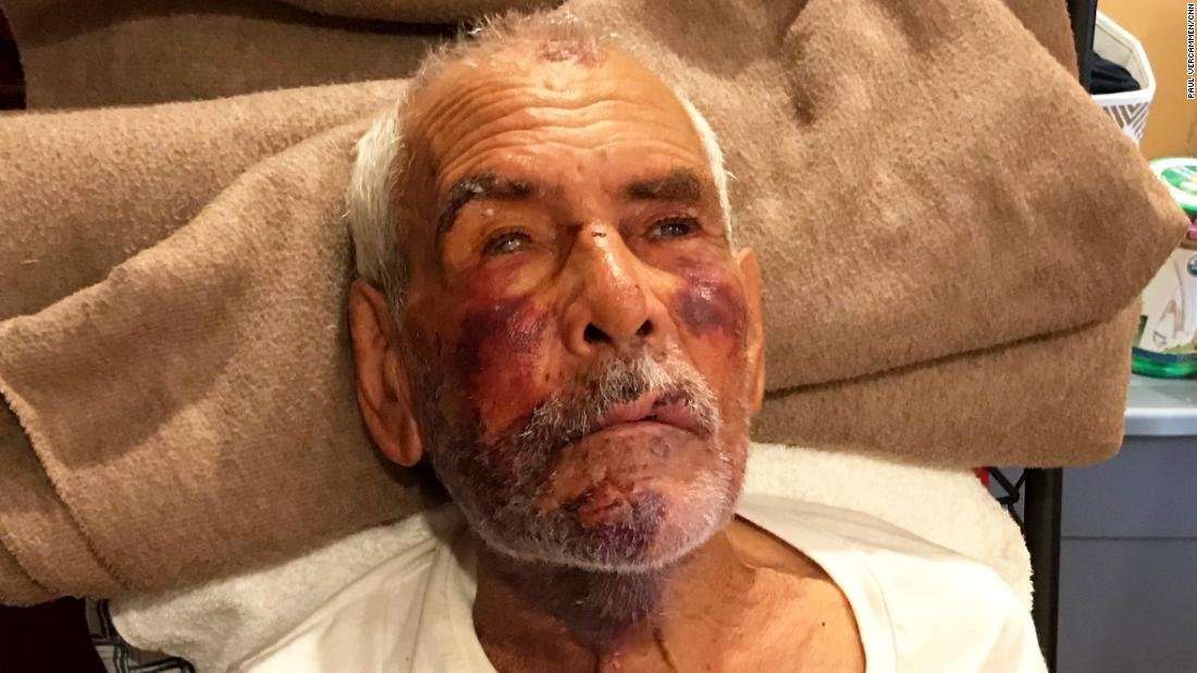 image for Arrest made in beating of 91-year-old who reportedly was told to 'go back to Mexico'