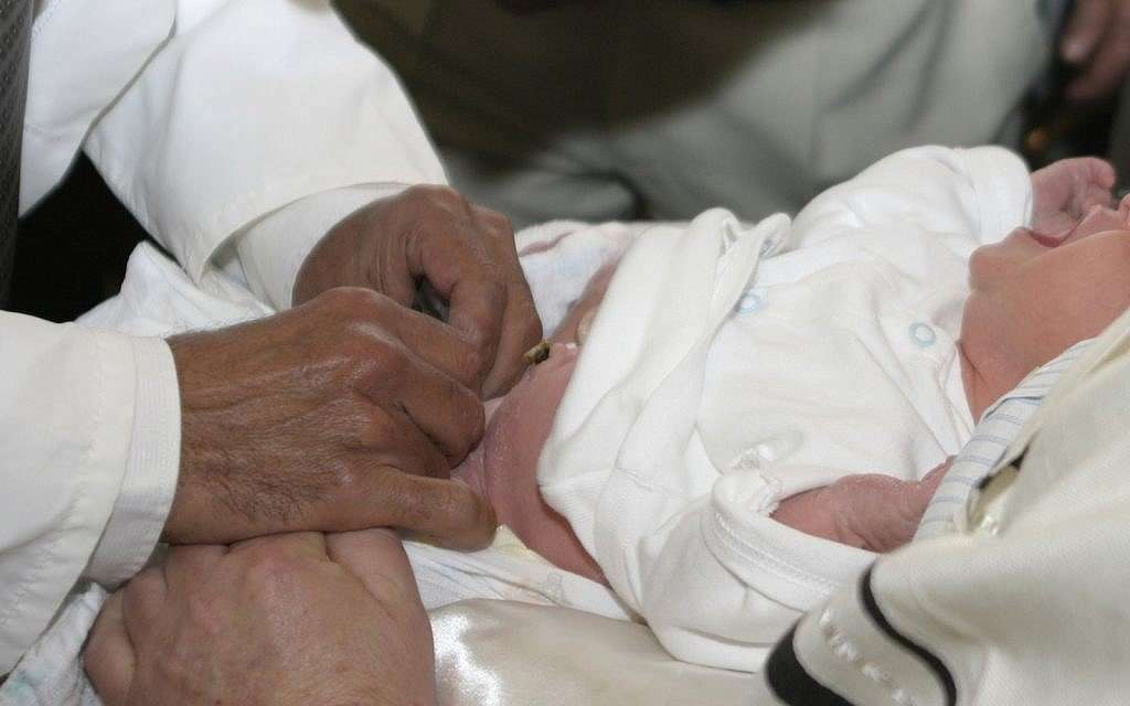 image for Norwegian hospitals refuse to assist in circumcisions
