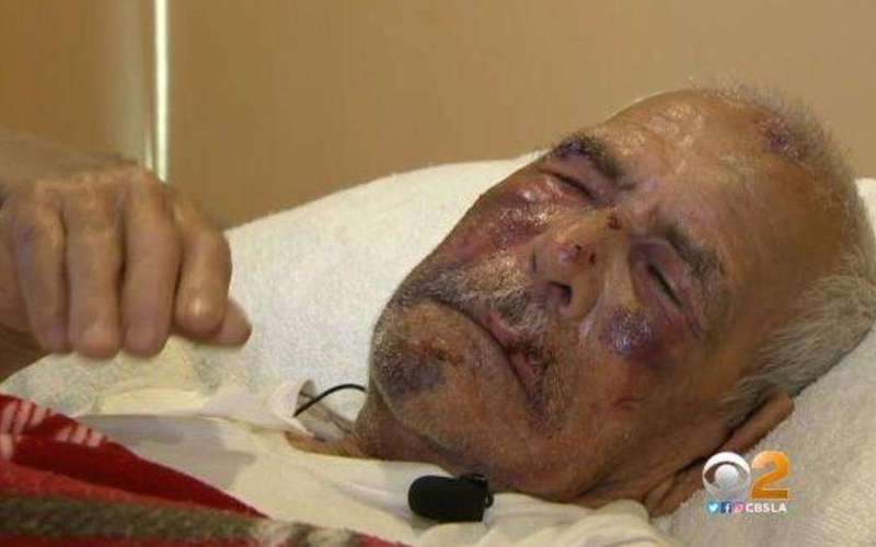 image for Woman charged with attempted murder in beating of man, 92, with brick
