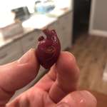 image for This small red potato looks like an anatomical heart
