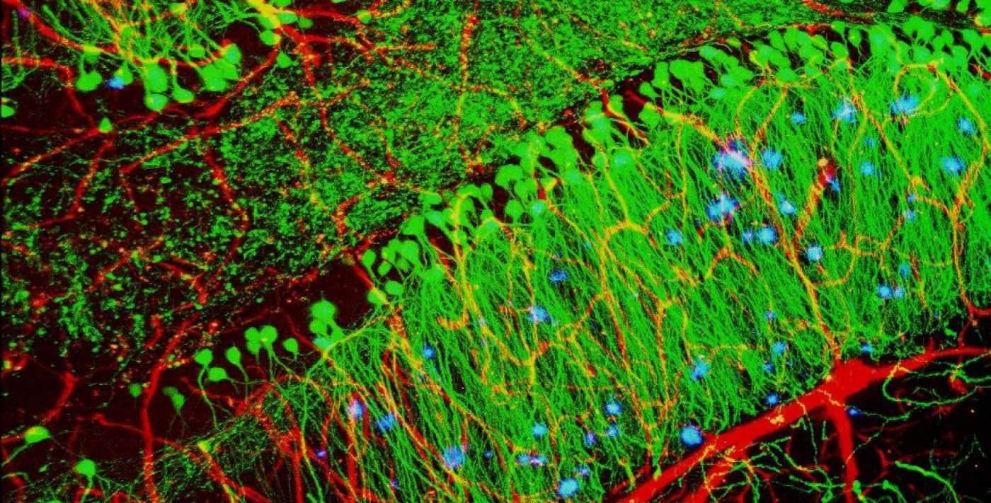 image for Research reveals a potential new biotherapy for Alzheimer’s disease