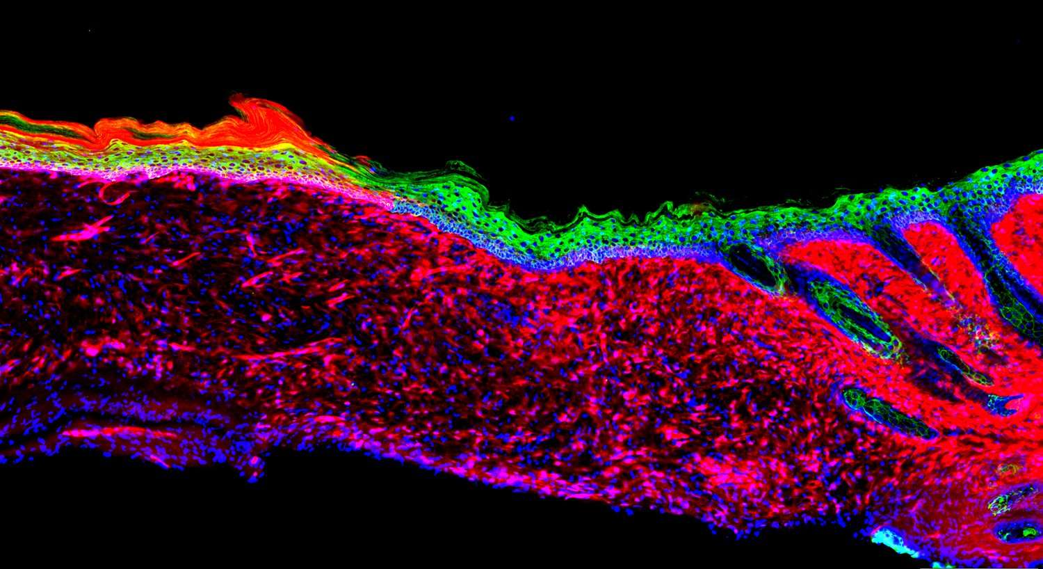 image for The alchemy of healing: researchers turn open wounds into skin