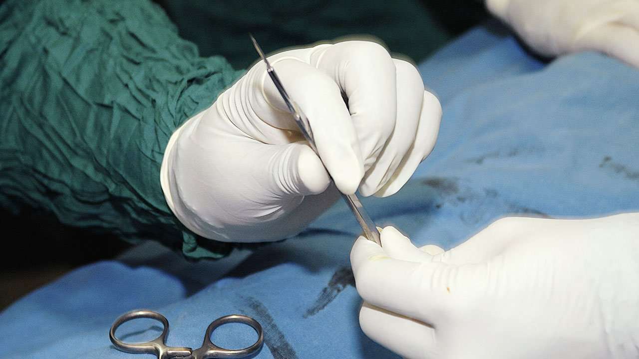image for Florida Doctor Removes Woman's Kidney After Mistaking It for Tumor During Back Surgery