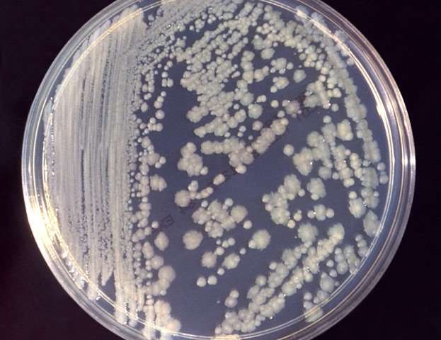 image for Antibiotic-resistant bacteria found on space station toilet