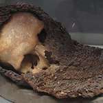 image for A medieval skull fused with chainmail. The soldier died at the Battle of Visby in 1361 in Gotland, Sweden. He was buried in his armour