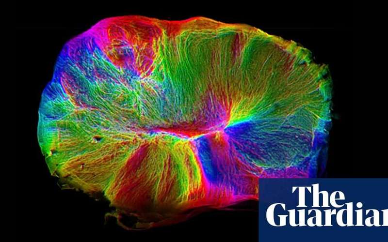 image for Scientists grow 'mini-brain on the move' that can contract muscle