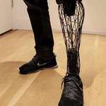 image for Prosthetic legs can how be made from 3D-printed titanium