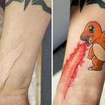 image for Charmander tattoo making use of a scar