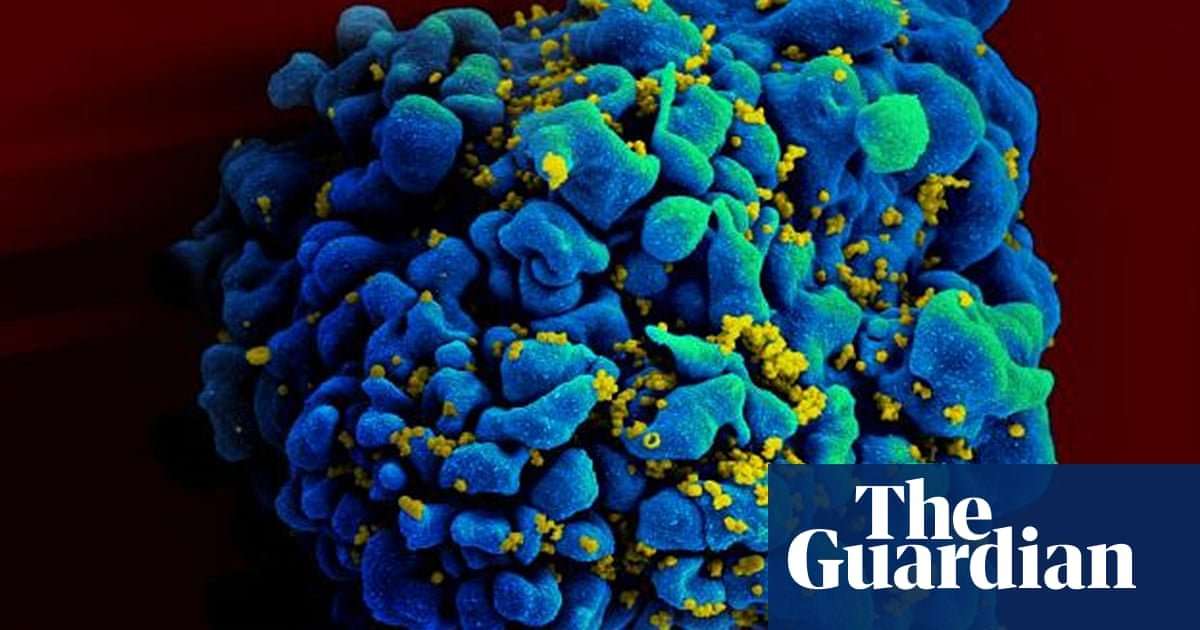 image for End to Aids in sight as huge study finds drugs stop HIV transmission