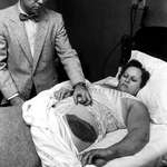 image for Dr. Moody Jacobs shows a giant bruise on the side and hip of his patient, Ann Hodges, after she was struck by a meteorite. She is the only confirmed person in history to have been hit by a meteorite (1954).