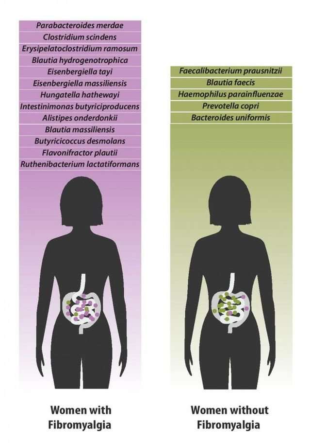 image for Unique Gut Microbiome Composition May Be Fibromyalgia Marker