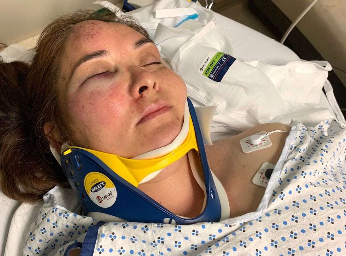 image for N.J. mom beaten unconscious by school bully who threatened her son in hate crime, lawyer says