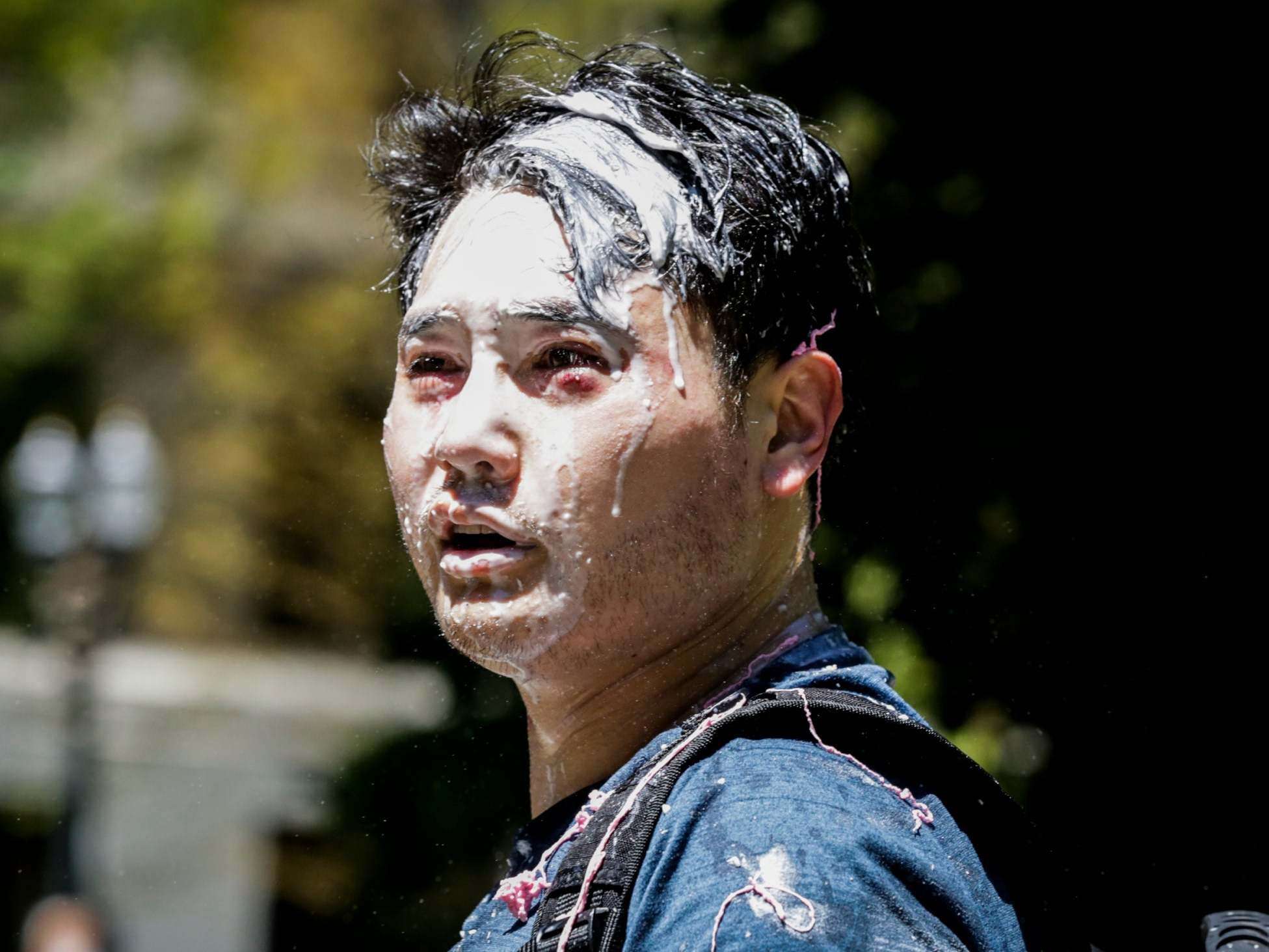 image for Antifa attack conservative blogger Andy Ngo amid violence at Portland Proud Boys protest