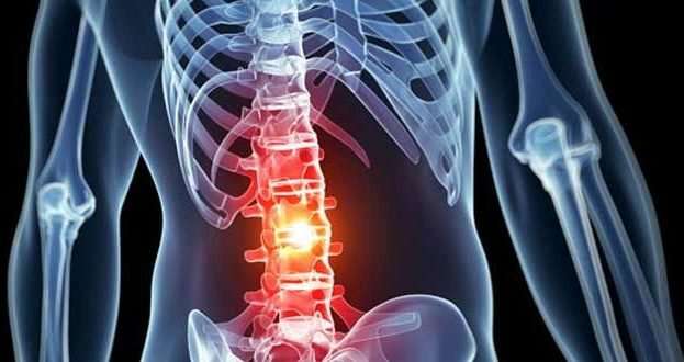 image for An 'EpiPen' for spinal cord injuries