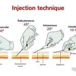 image for Injection techniques