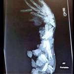 image for Cursed_xray
