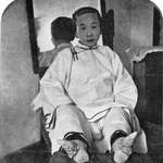 image for A Chinese lady whose feet were bound from childhood. Late 1800s. [937x967]