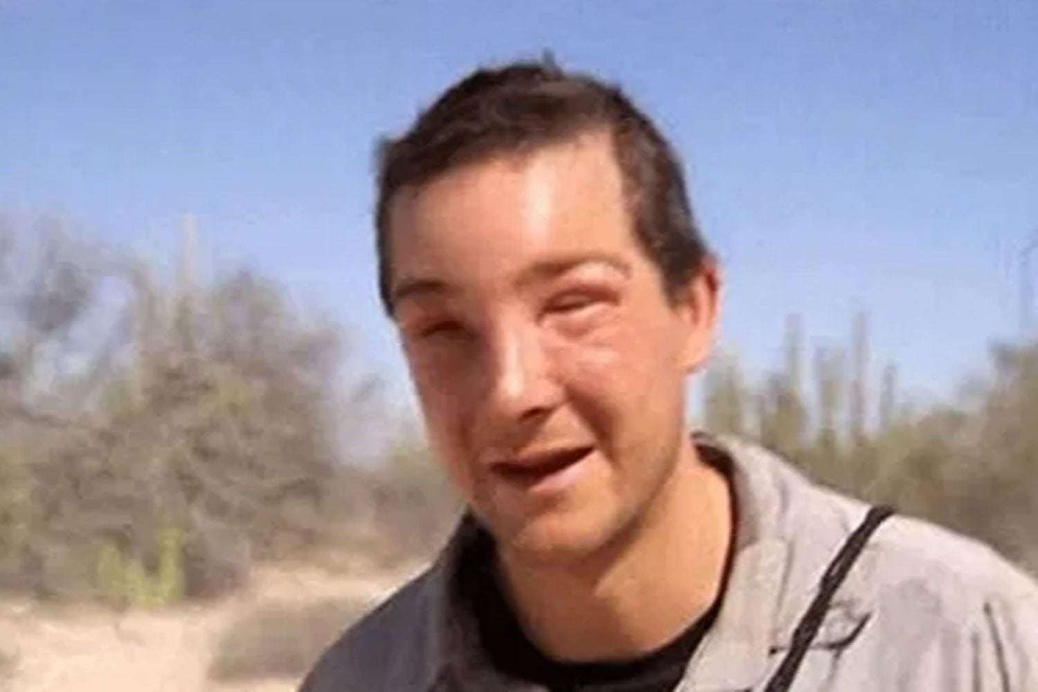 image for Bear Grylls rescued by medics after life-threatening allergic reaction to bee sting