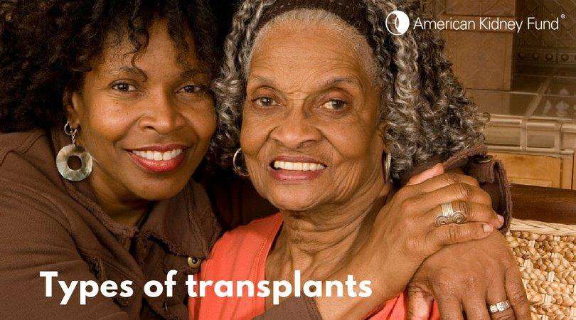 image for TIL about "paired kidney exchange", which allows you to donate your kidney that wasn't a match for your intended recipient (spouse, child, etc.) to a stranger but in turn receive a kidney that is a match for your loved one. Instead of two people going without a transplant, both get a transplant.