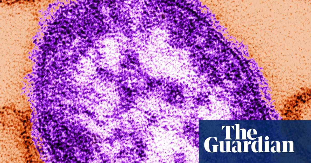 image for Measles wipes out immune system's memory, study finds