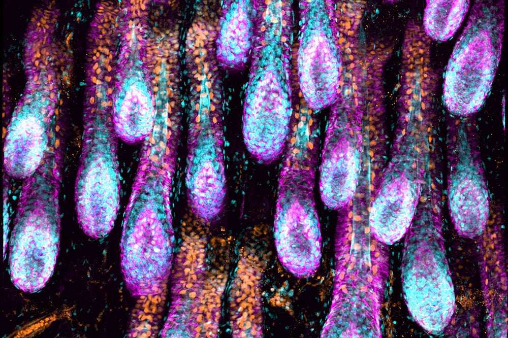 image for Lymphatic system found to play key role in hair regeneration