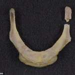 image for Epstein's autopsy found his neck had been broken in several places, incl. the hyoid bone (pic): Breakages to that bone are commonly seen in victims who got strangled. Going over a thousand hangings, suicides in the NYC state prisons over the past 40–50 years, NONE had three fractures.