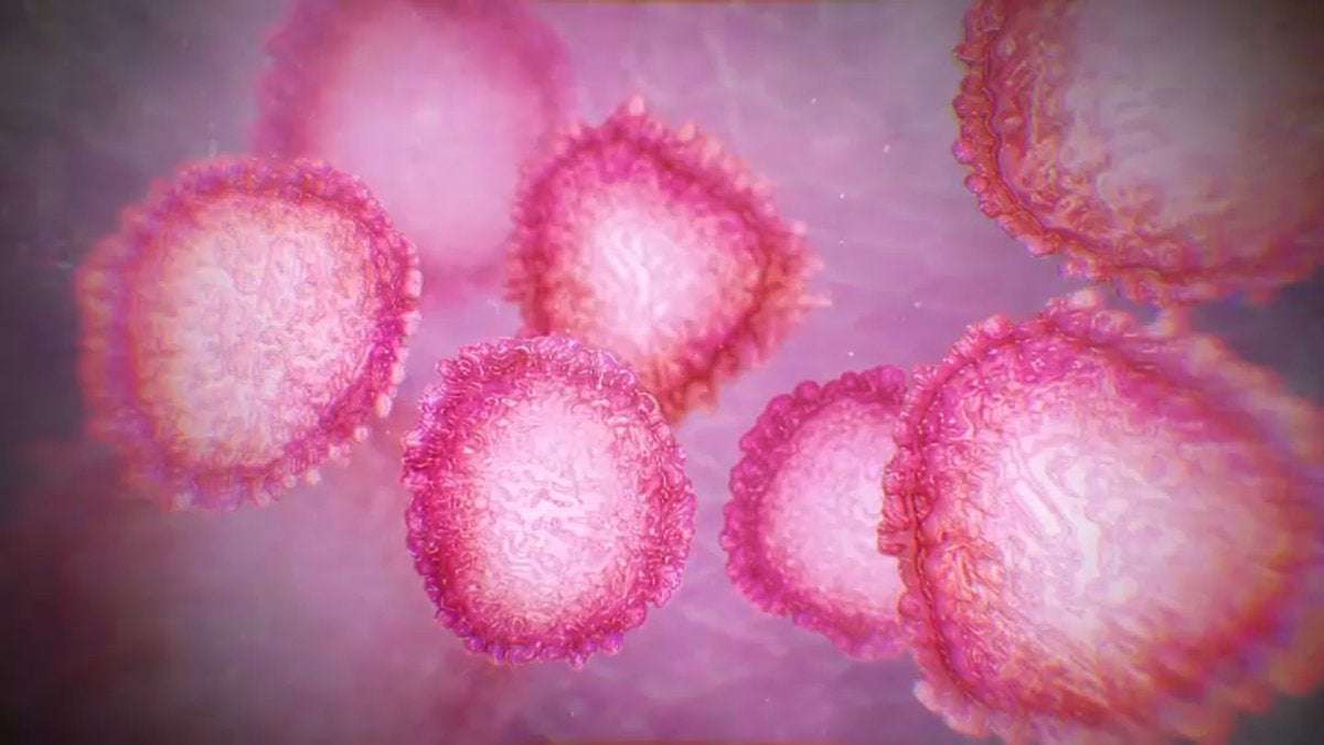 image for Orange County’s First Case of Deadly Novel Coronavirus Confirmed
