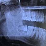 image for Dentist told me “See that there? That’s not normal” worst pain of my life.