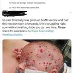 image for Anti-vaxxers caught lying again.