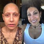 image for During her battle with cancer and after she beat it