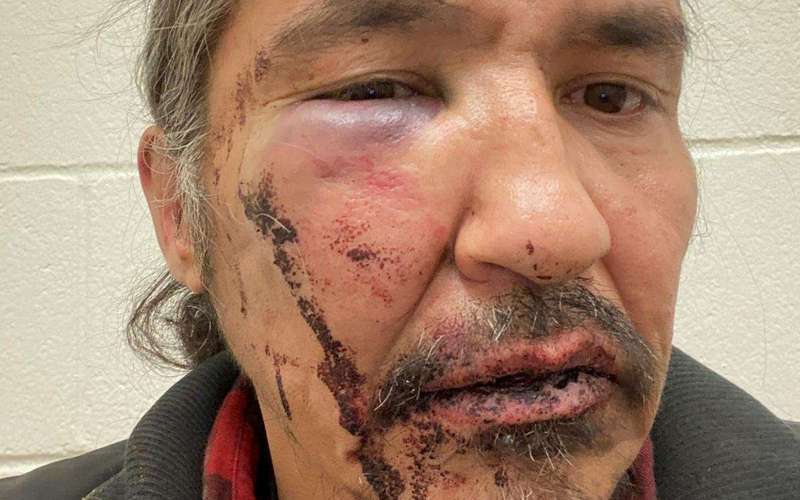 image for Indigenous chief says Canadian police beat him over expired licence plate