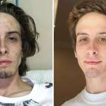 image for Before and after rehab