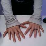 image for Girl came into my work and after a bit of conversation showed me that she had 6 fingers on each hand. This isn't photoshopped. This is an actual photo of a customer who came into the phone store I work at in Summerville, S.C.