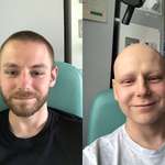 image for The difference three months of hardcore chemotherapy makes!