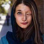 image for Marzieh was driving in Iran when two men motorcyclist though acid on her face. She is beautiful